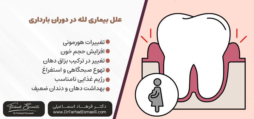 علل بیماری لثه در دوران بارداری | دکتر فرهاد اسماعیلی