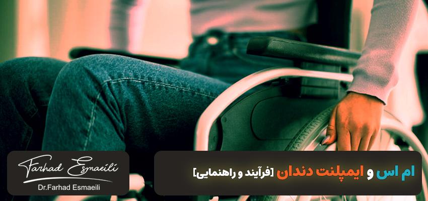 ام اس و ایمپلنت دندان [فرآیند و راهنمایی] | دکتر فرهاد اسماعیلی در اصفهان