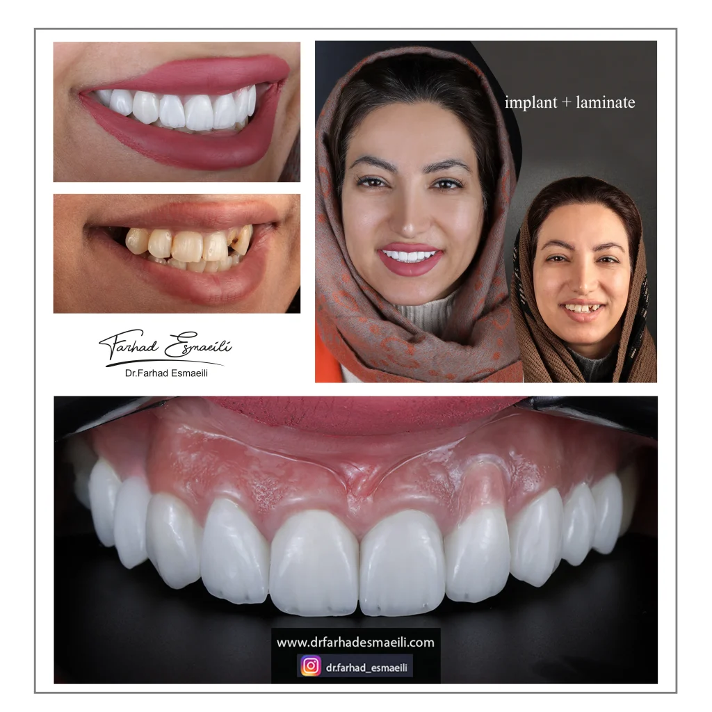 دندانپزشکی دیجیتال دکتر فرهاد اسماعیلی