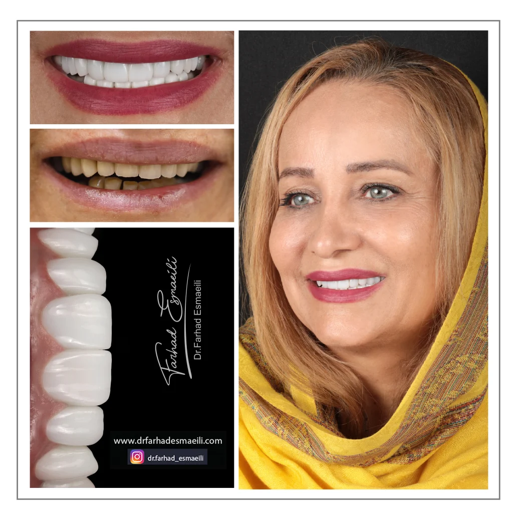 دندانپزشکی دیجیتال دکتر فرهاد اسماعیلی