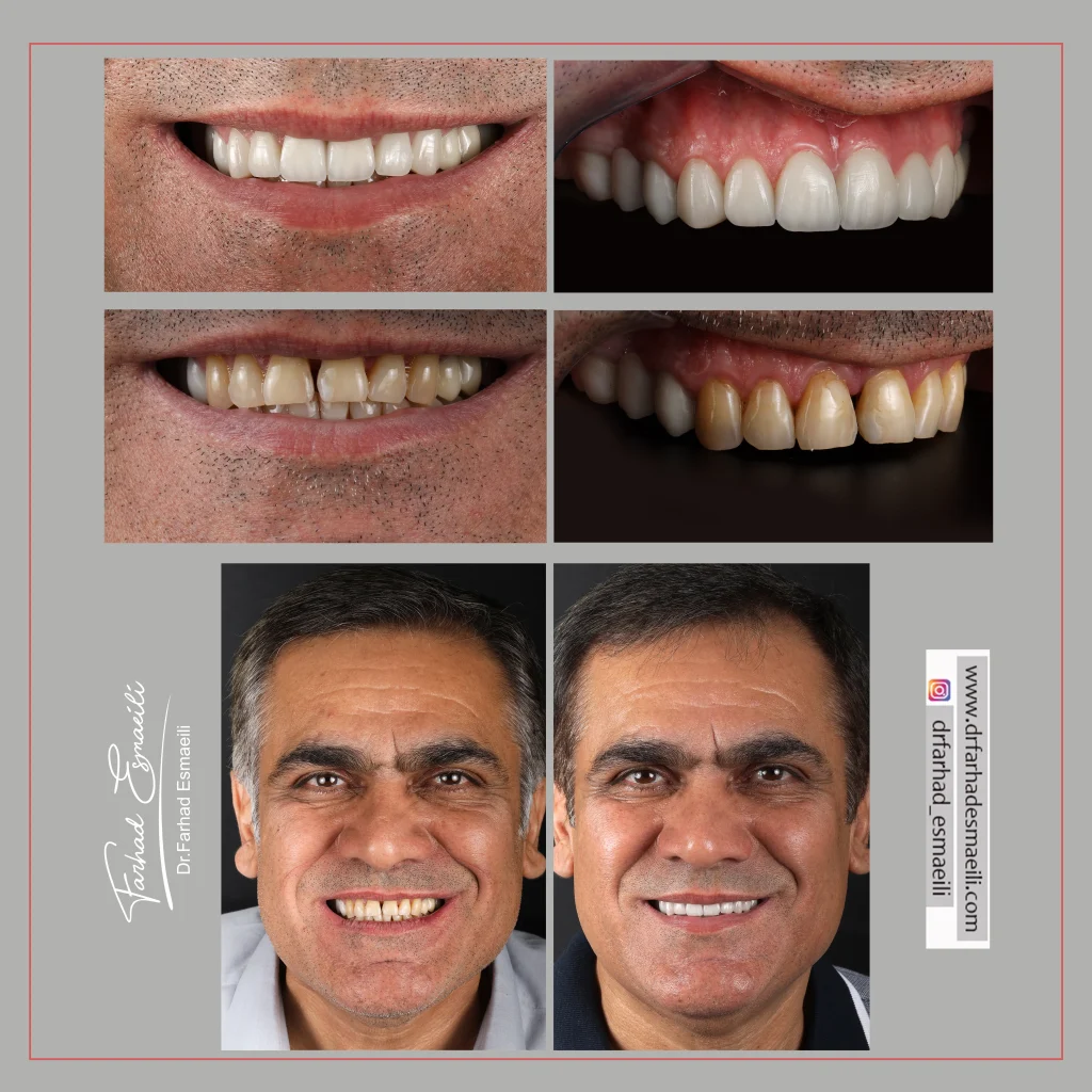 دندانپزشکی دیجیتال دکتر فرهاد اسماعیلی