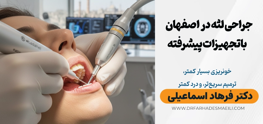 بهترین متخصص جراحی لثه در اصفهان دکتر فرهاد اسماعیلی