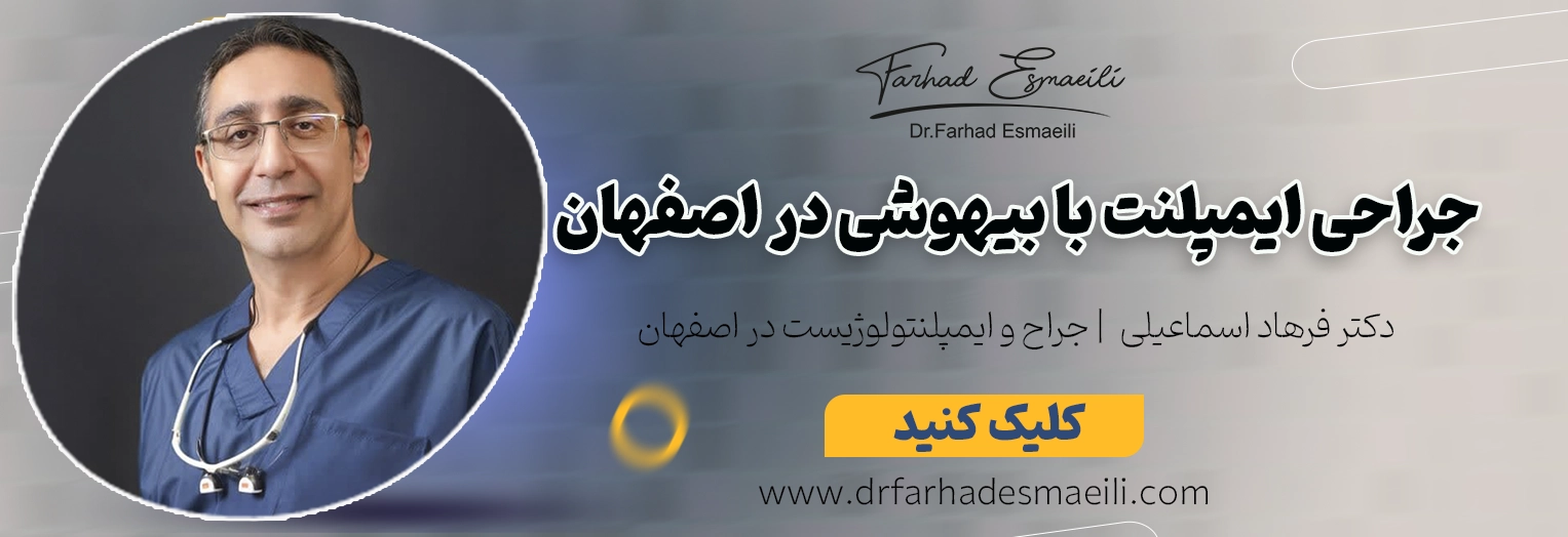جراحی ایمپلنت با بیهوشی در اصفهان توسط دکتر فرهاد اسماعیلی
