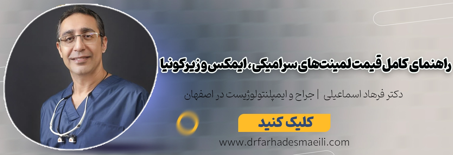 هزینه لمینت دندان در اصفهان راهنمای کامل قیمت لمینتهای سرامیکی، ایمکس و زیرکونیا