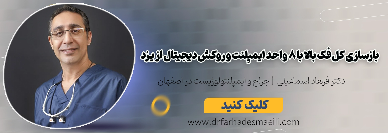 بازسازی کامل فک بالابا 8 واحد ایمپلنت در اصفهان توسط دکتر فرهاد اسماعیلی