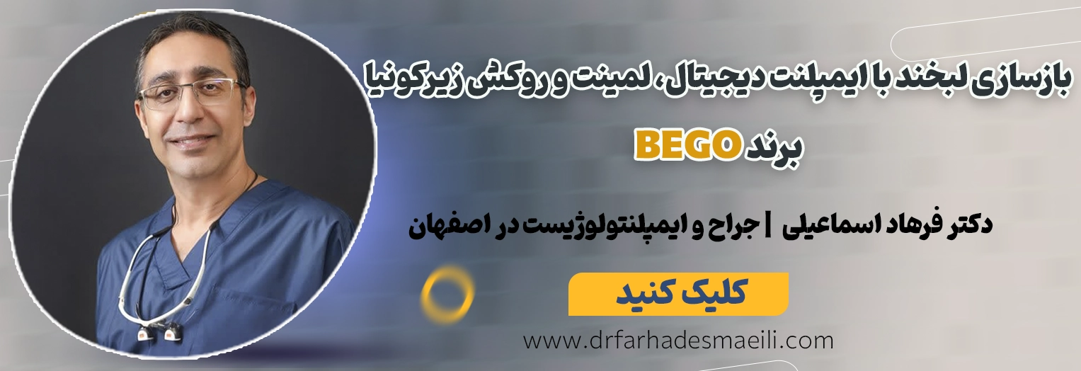 بازسازی جامع لبخند با ترکیب ایمپلنت BEGO، جراحی لثه و لمینت سرامیکی در اصفهان توسط دکتر فرهاد اسماعیلی
