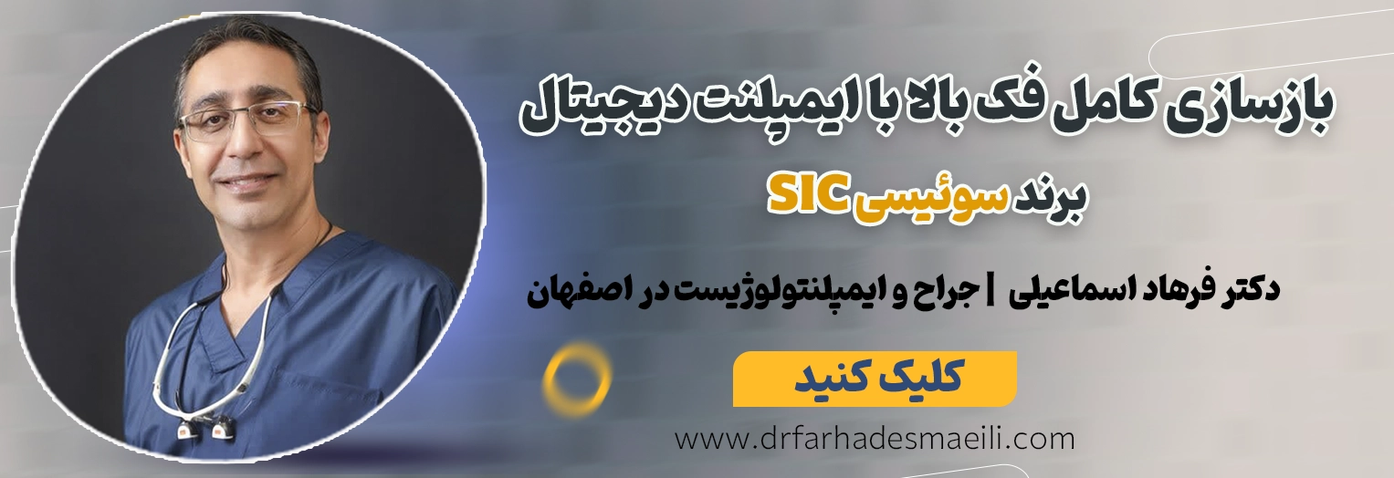 رزرو نوبت برای بازسازی کامل فک بالا با ایمپلنت دیجیتال در اصفهان توسط دکتر فرهاد اسماعیلی