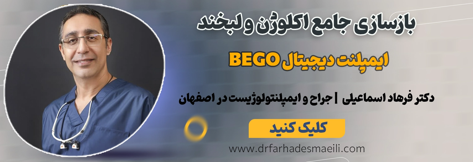 بازسازی جامع اکلوژن و لبخند توسط دکتر فرهاد اسماعیلی