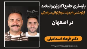 بازسازی جامع اکلوژن و لبخند: درمان میان‌رشته‌ای (ارتودنسی، ایمپلنت و پروتزهای سرامیکی)