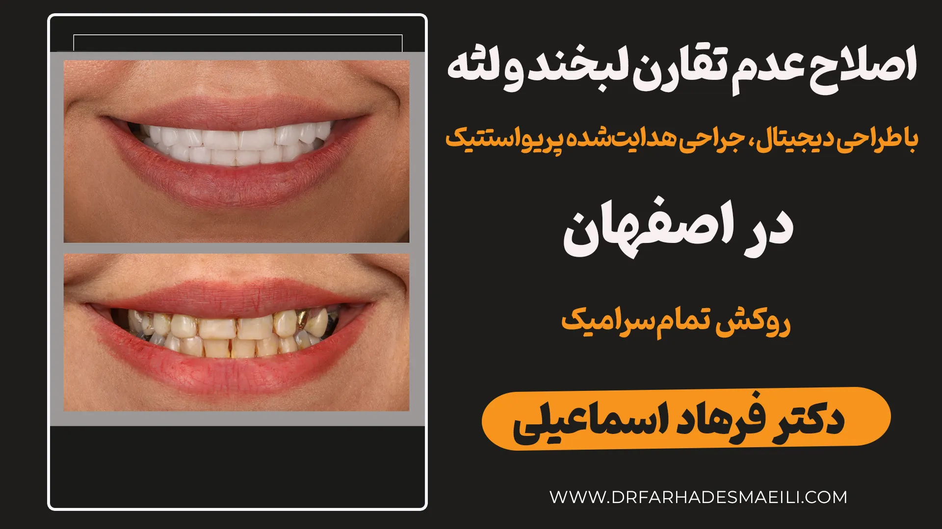 کیس استادی: اصلاح جامع ناهنجاریهای لبخند با جراحی دیجیتال پریواستتیک