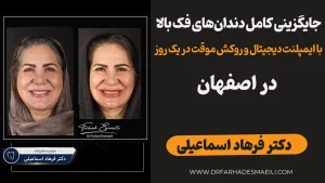 جایگزینی کامل دندان‌های فک بالا با ایمپلنت دیجیتال و روکش موقت در یک روز